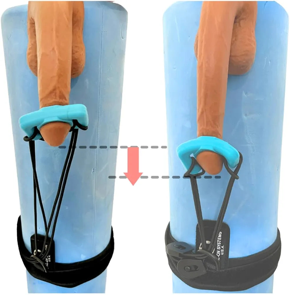 Universal Adjustable Penis Extender and Traction Device for Discreet Daily Wear