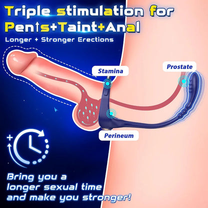 SOARPPIE Vibrating Prostate Massager and Anal Bead Stimulator for Men