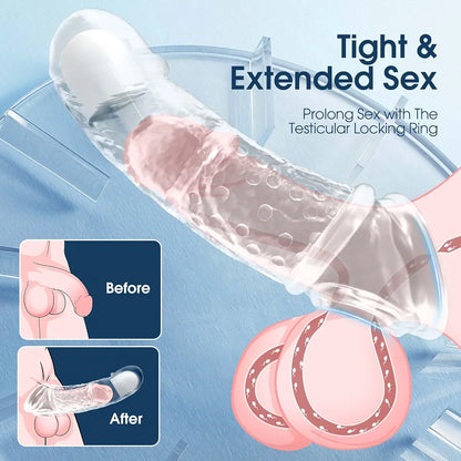 Vibrating Penis Sleeve for Couples – Adds Girth & Length, Remote Control Vibrations, Elastic Fit for Enhanced Intimacy, 2 Sets